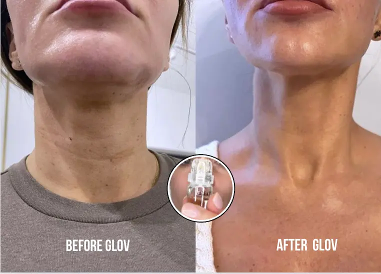 Anti-Aging treatment - Image 8