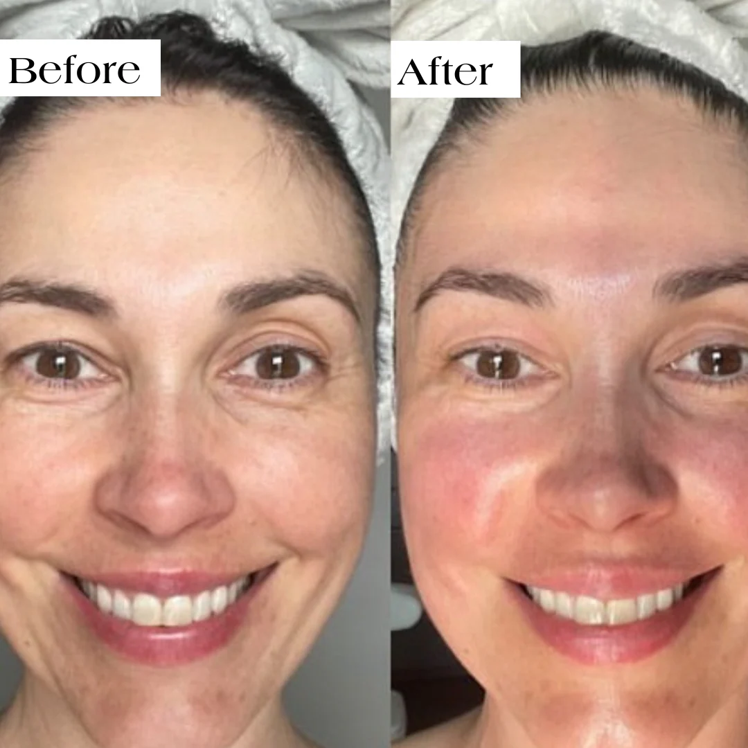 Glov Collagen Mask - Image 3