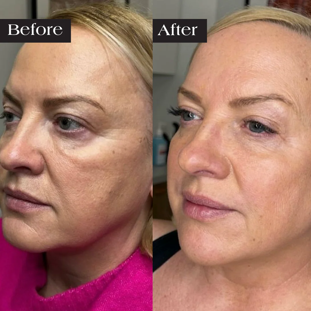 Glov Collagen Mask - Image 6