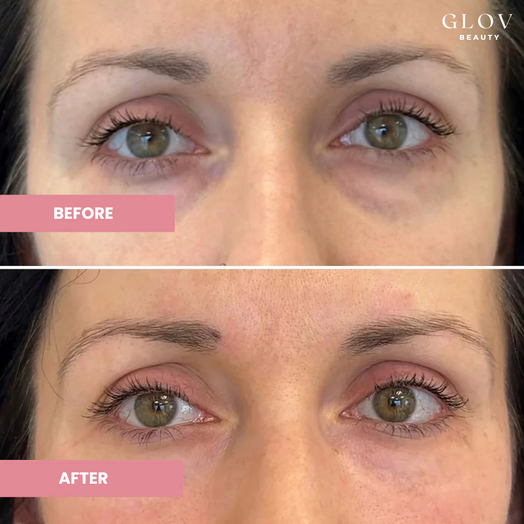 Glov Hydrate & Brighten Eye Cream BOGO - Image 5