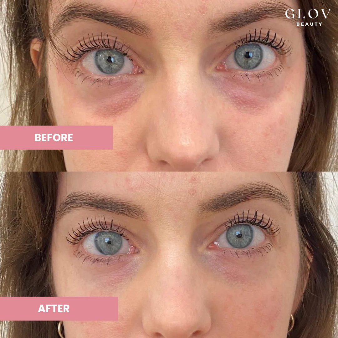 Glov Hydrate & Brighten Eye Cream BOGO - Image 6