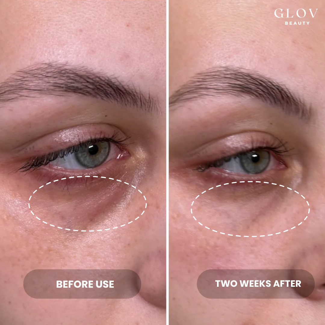 Glov Hydrate & Brighten Eye Cream BOGO - Image 7