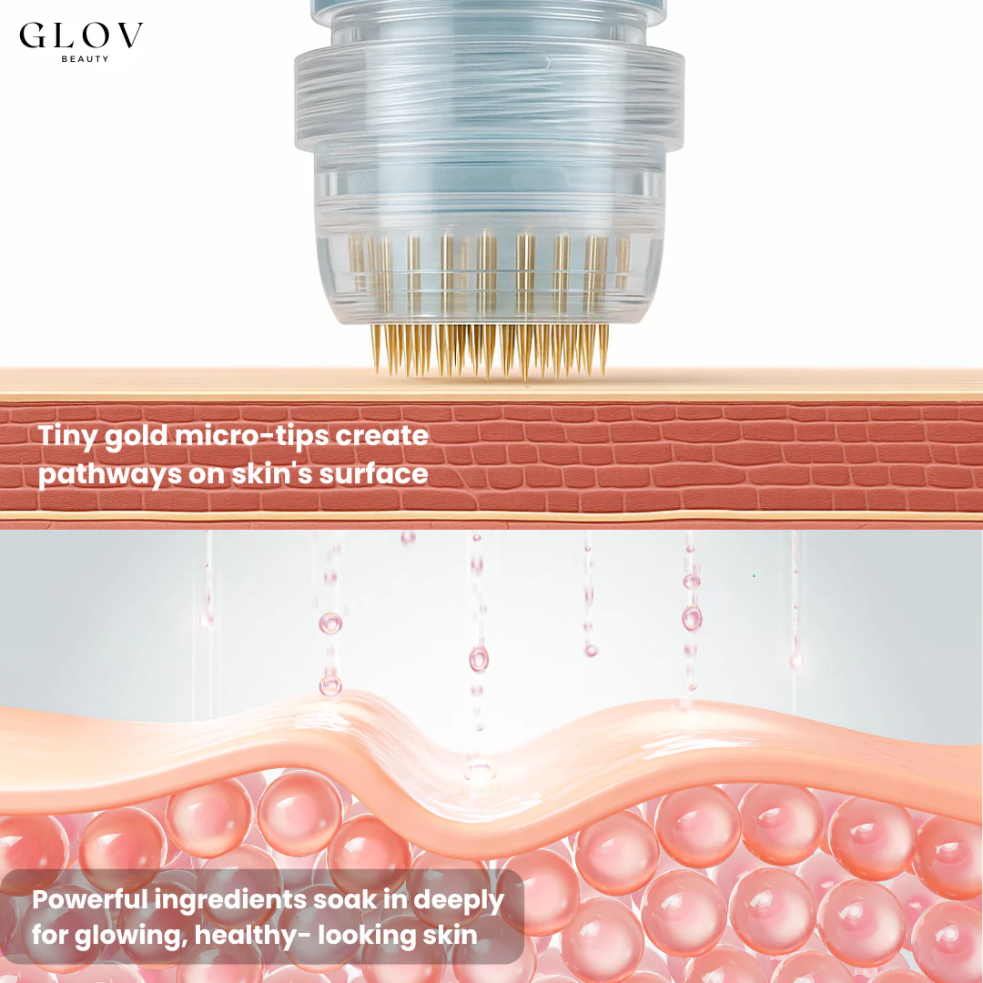 Glov Micro Infusion System - Image 4
