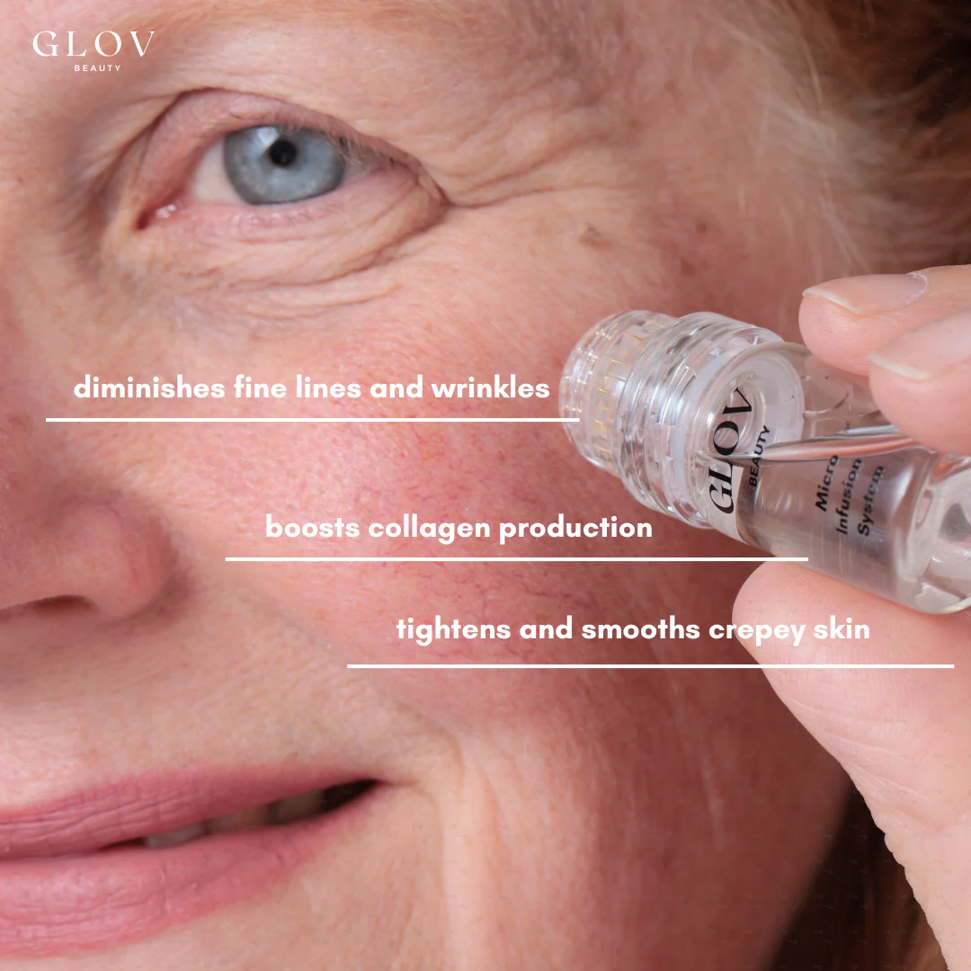 Glov Micro Infusion System - Image 10