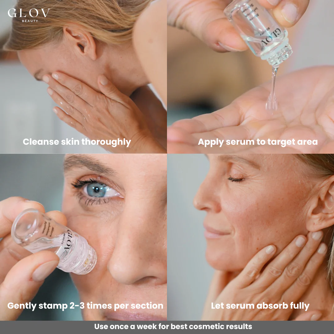 Glov Micro Infusion System - Image 5