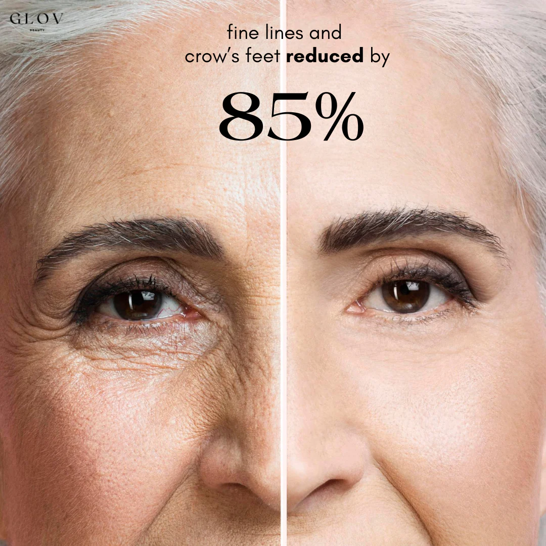 Glov Intense Rejuvenation Eye Gel Patches - Image 6